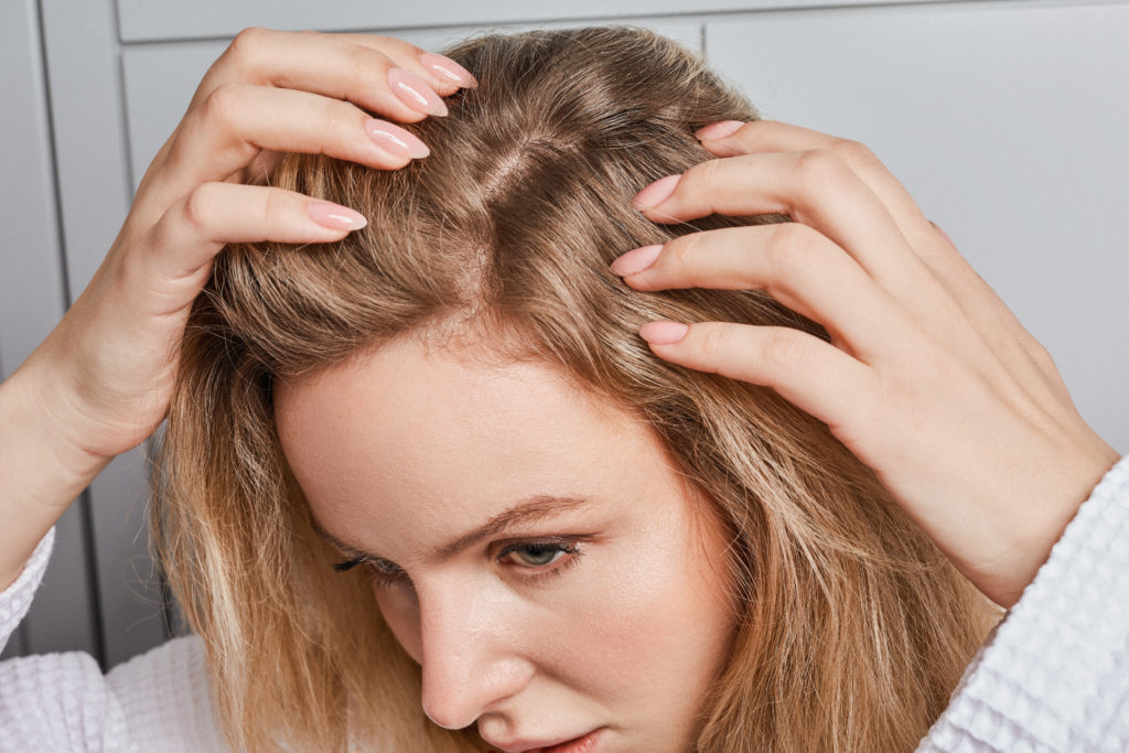 Kobieta oceniająca stan gęstości swoich włosów. Jest po 6-tygodniowej kuracji szamponem i serum Hair Cure i widzi pierwsze efekty w postaci odrastających włosów tam, gdzie były zakola. 